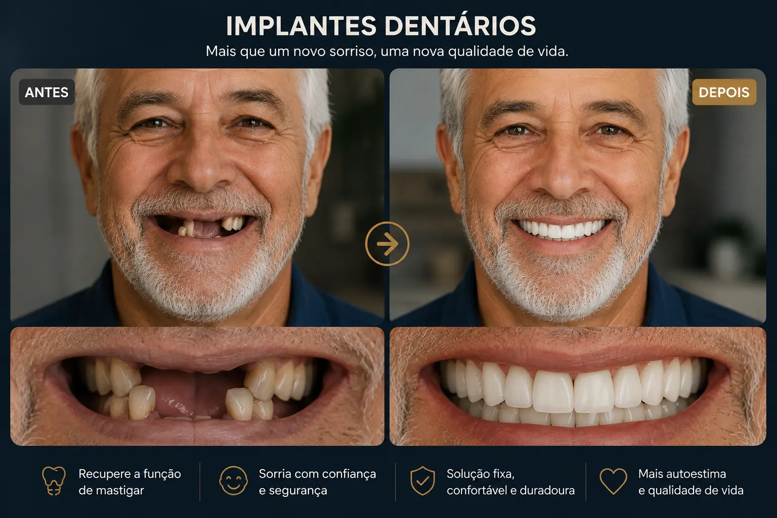 Resultado de tratamento com implantes dentários